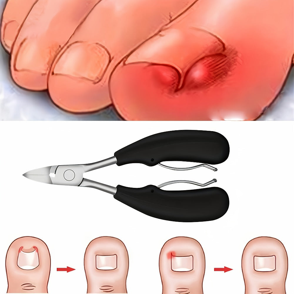 5 Thick Toenail Clippers, Senior Toenail Clippers, Thick Toenail Clippers, Large Opening Nail Clippers, Heavy Inward Growing Toenail Clippers, Diagonal Nail Clippers, Nail File, Big Toe Clippers For Men, Senior Women