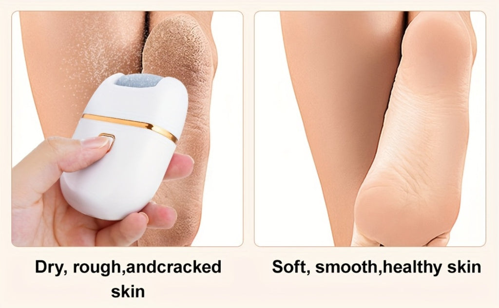 2Set 6Heads And 1Set 3Heads, Rechargeable Electric Foot Grinder for Cracked Heels & Removal - Thick Light Beige Polishing, 3Replacement Grinding Heads, 2Speed Settings, Portable And Easy to Use with USB Charging, IPX5