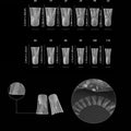 10pcs 1.18inch Long French AB Diamond Shiny Duckbill Nude Color Versatile Pure Handmade Wearable Nails Press-On Artificial Nails Suitable for Back-To-School Season, Parties, Dates, Weddings