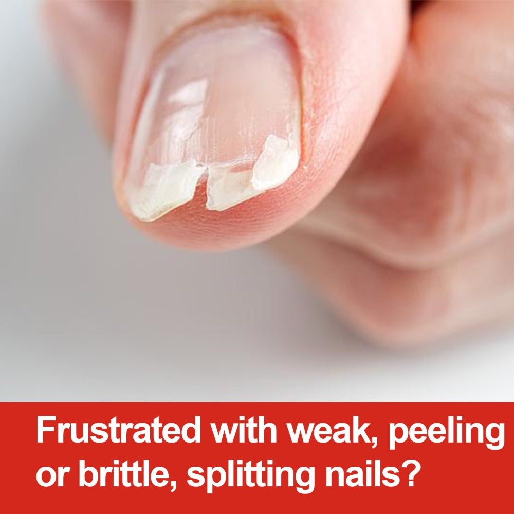 Keratin 3 Day Nail Hardener - Quick-Drying, Glossy End, Strengthens And Safeguards Nails, Moisturizes, Hydrates, Softens, And Illuminates, Liquid Form, for Adult Use, Alcohol-Free Ingredients - Fortifying Nail