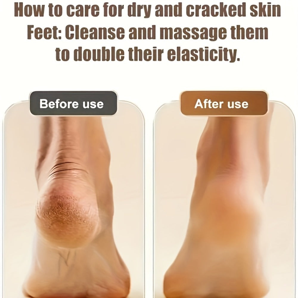 2Set 6Heads And 1Set 3Heads, Rechargeable Electric Foot Grinder for Cracked Heels & Removal - Thick Light Beige Polishing, 3Replacement Grinding Heads, 2Speed Settings, Portable And Easy to Use with USB Charging, IPX5