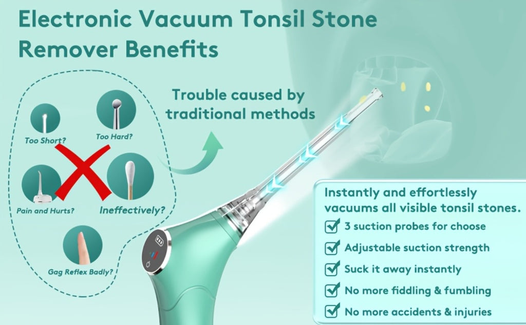 Electronic Vacuum Tonsil Stone Remover - Tonsil Stone Removal Kit with Built-In LED Light & 3 Suction Mode - Fight Oral Irrigator & 5X Magnifying Mirror for Tonsil Stone Removal, Local Warehouse, Christmas Gifts
