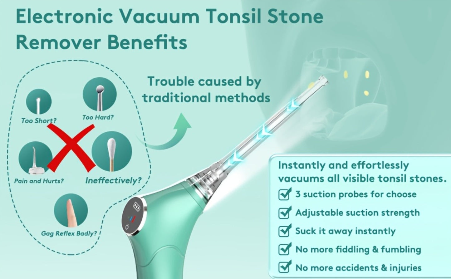 Tonsil Stone Remover Electric Vacuum Kit — Built-In LED Light, 3 Suction Modes, 5X Magnifying Mirror, Oral Irrigator for Effective Tonsil Stone Removal at Home