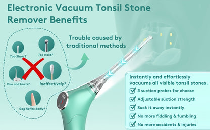 Tonsil Stone Remover Electric Vacuum Kit — Built-In LED Light, 3 Suction Modes, 5X Magnifying Mirror, Oral Irrigator for Effective Tonsil Stone Removal at Home