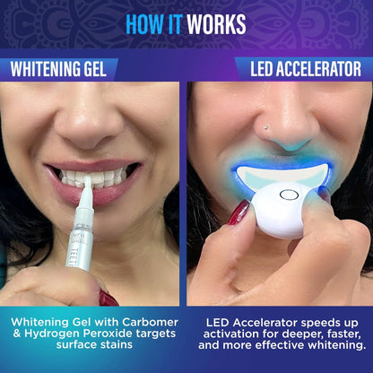 Teeth Whitening Kit with LED Light — Wireless 16-LED Blue Light, Whitening Gel Pen, 40 Treatments, Removes Coffee & Food Stains for a Brighter Smile at Home