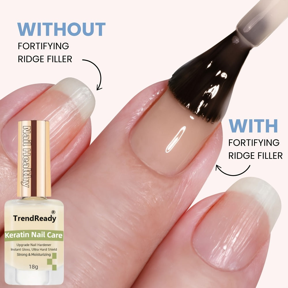 [Christmas Gift] 6/2pcs 15ml Nail Hardener | Pink/White/Yellow Color, Extra Strong for Weak Nails, Long Lasting & Fast Drying, Manicure Essentials, Nail Care, Smoothes Nails, Ideal for Christmas Gift, Black Friday