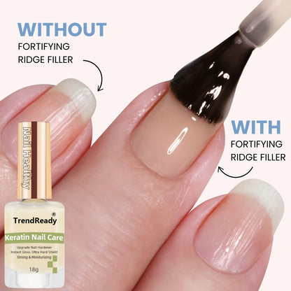 Nail Hardener Set | Extra Strong 15ml Pink, White & Yellow Colors for Weak & Splitting Nails — Long Lasting Fast Drying Manicure Essentials, Available in 2-Pack & 6-Pack