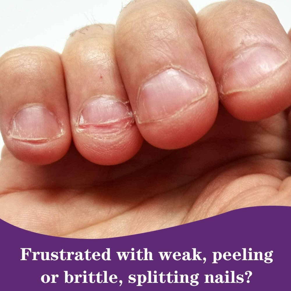 2-In-1 Super Strong Base And Cover Nail Polish - Long-Lasting, Chip-Resistant, High-Shine End - Nourishing Nail Care for Healthy, Beautiful Nails, Stop Nails from Chipping And Peeling