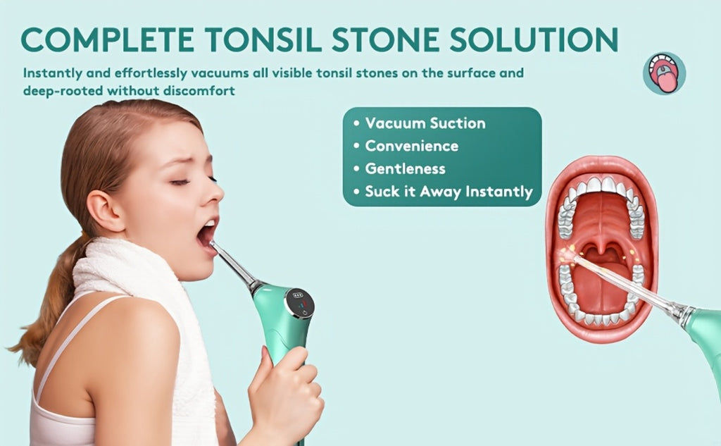 Electronic Vacuum Tonsil Stone Remover - Tonsil Stone Removal Kit with Built-In LED Light & 3 Suction Mode - Fight Oral Irrigator & 5X Magnifying Mirror for Tonsil Stone Removal, Local Warehouse, Christmas Gifts