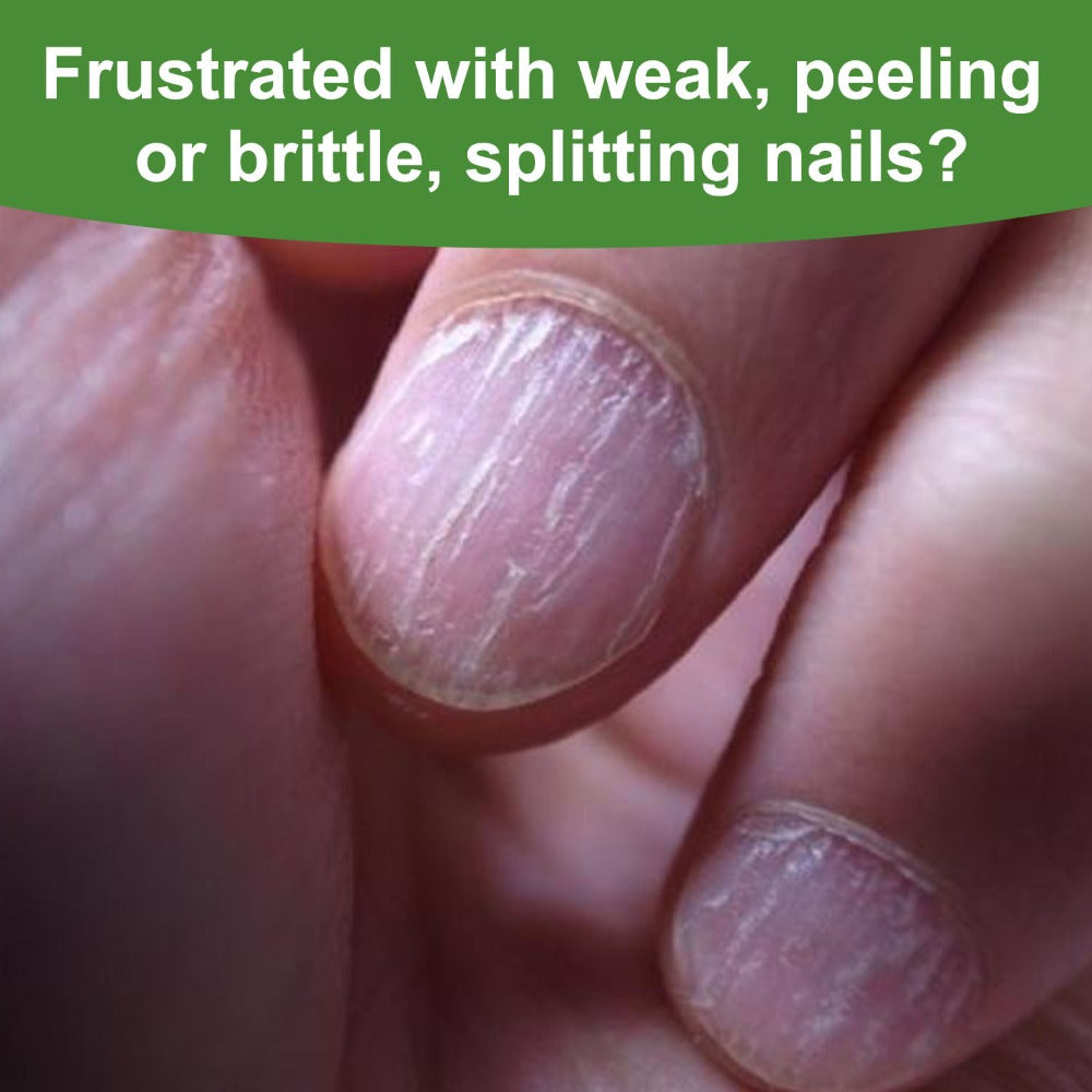 Nail Care Solution Enriched with Vitamin A to Strengthen Brittle And Dry Nails, Preventing Chipping And Peeling