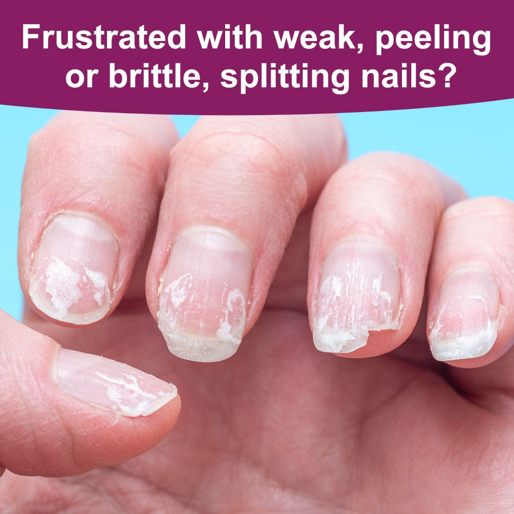 Nail Strengthener, Hardening Agent for Weak And Damaged Nails, Provides Protection to Make Nails Stronger And Tougher