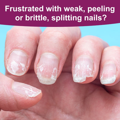 Nail Fortifier & Hardener 10ml Protective Strengthening Agent for Weak Damaged Brittle Nails – Makes Nails Stronger Tougher & Resilient, Clear Nail Repair Treatment Base Coat for Women