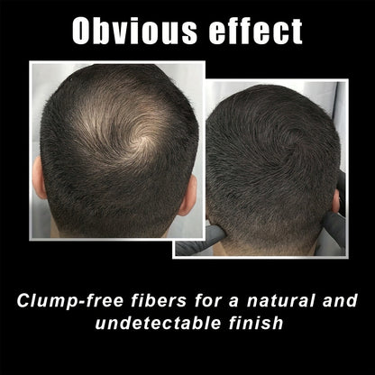 Hair Building Fibers 30g Large Size - Natural Look Thinning Hair Concealer for Volume & Thickness | Covers Hairline | Unisex | Black & Dark Brown