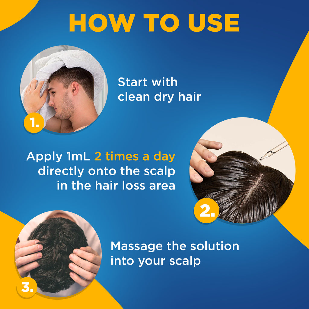 Kirkland Signature Minoxidil Liquid Extra Strength Hair Loss Regrowth Treatment for Men, 5% Topical Solution for Hair Growth