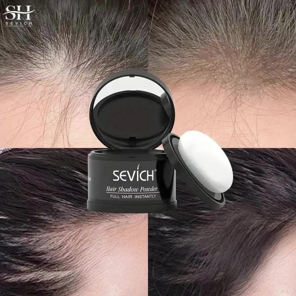 Sevich Hairline Powder, Hairline Concealer And Volumizing Powder for All Hair Types, Root Touch Up And Cover Up