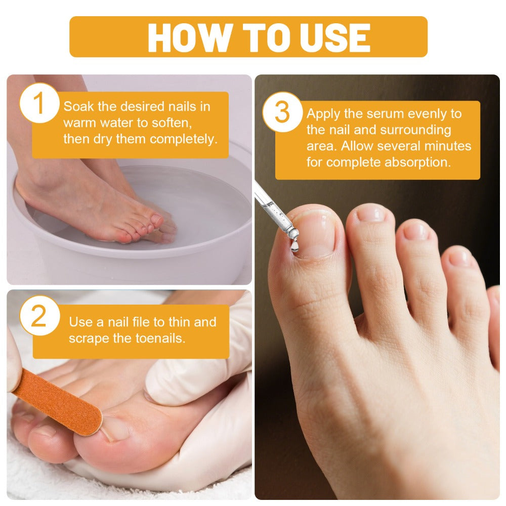 Bee Venom Toenail Care Solution: Extra Strength Formula for Toenail Issues - Nail Care Solution for Toes - Extra Strength Nail Care Solution - Visible Results in 7 Days - 1. 01fl. Oz