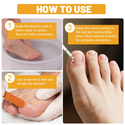 Bee Venom Toenail Repair Solution Extra Strength Toenail Treatment for Damaged Discolored Nails Nail Restoration Serum Visible Results in 7 Days 1.01 fl oz