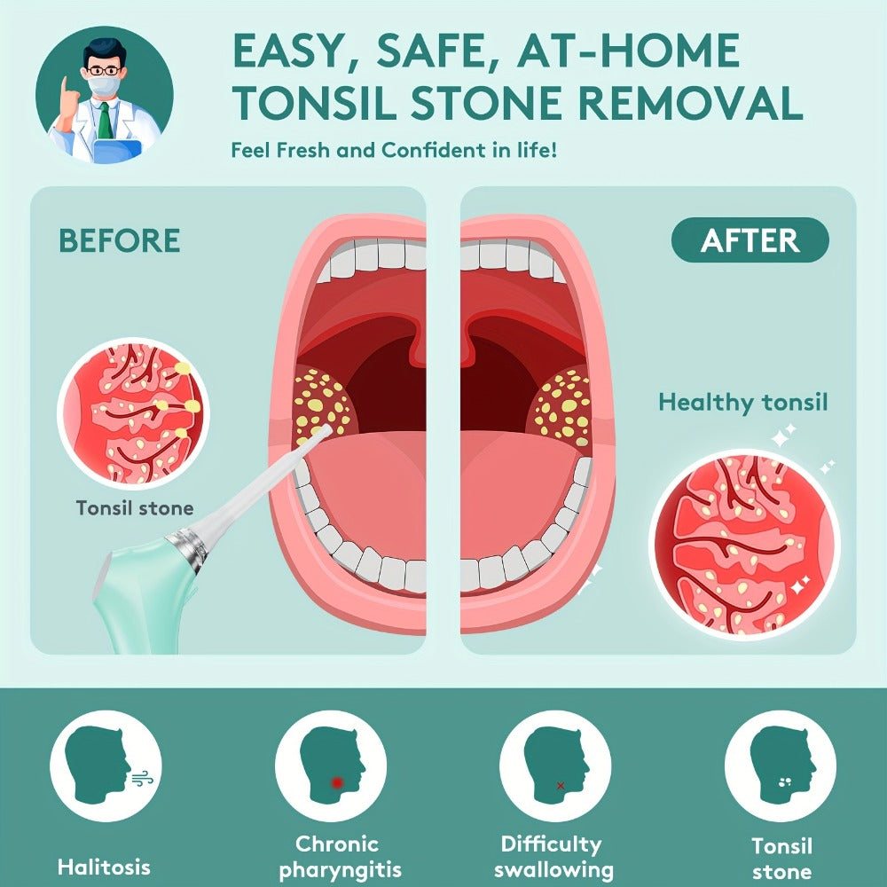 Tonsil Stone Remover Electric Vacuum Tonsil Stone Removal Kit with LED Light 3 Suction Modes 5X Magnifying Mirror Oral Irrigator Tool for Safe Gentle Tonsillolith Removal Adults